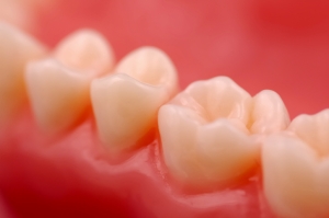 Close-up-of-teeth1